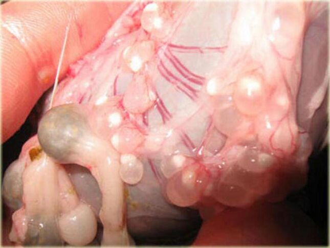 Cysticercus larvae under the skin.