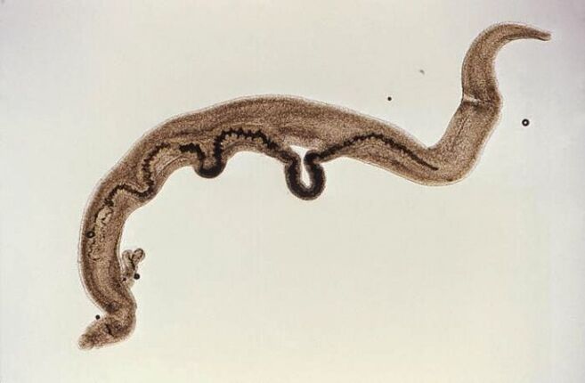 Schistosoma parasite inside the body.