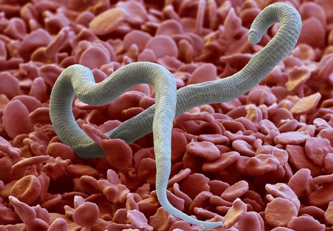Parasitic worm that feeds on the human body.
