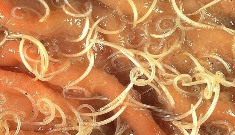 human body worms
