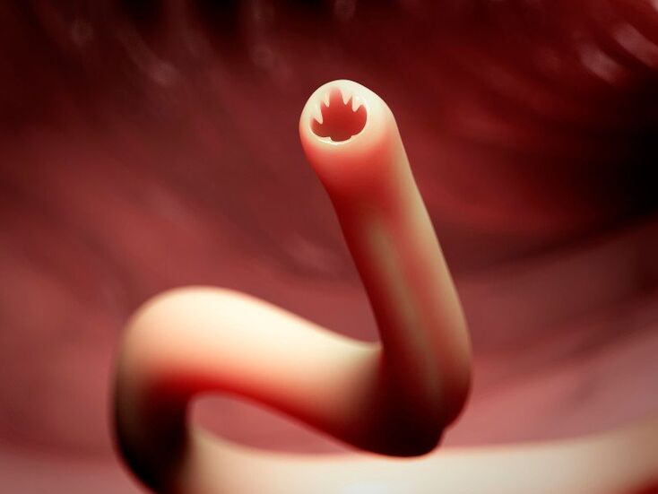 worm inside the human body